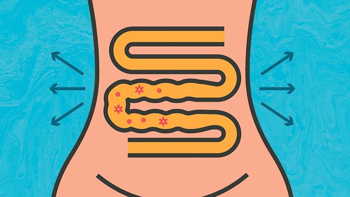 Diarrhea and IBS: How to Ease Symptoms